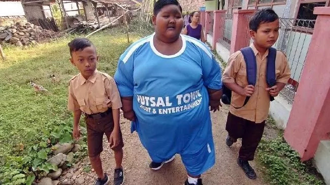 Obese boy, 10, who was constantly hungry and weighed 192kg loses 20kg after surgery