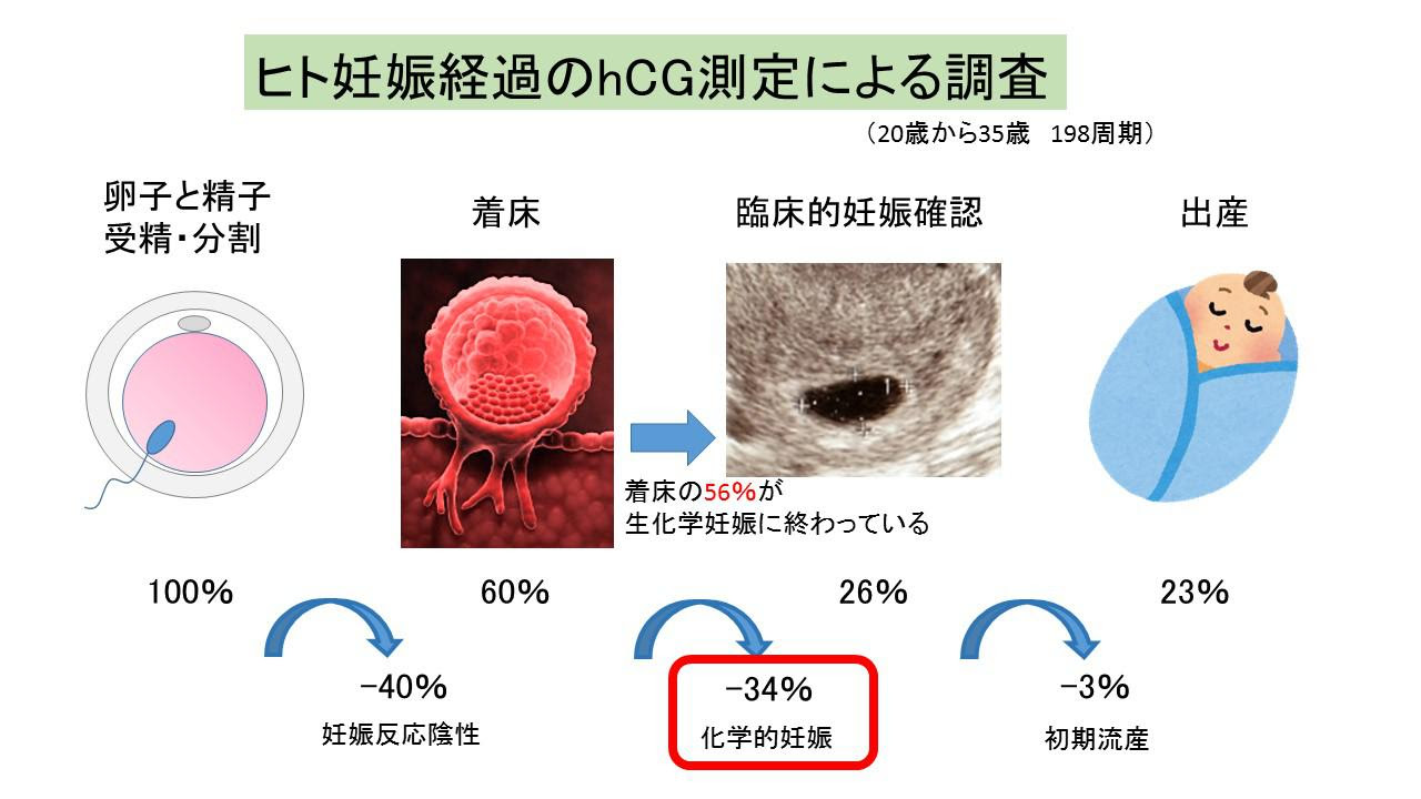 超極初期流産 よくあるご質問 徐クリニック