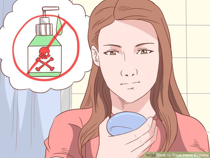 Treat Hand Eczema Step 15.jpg