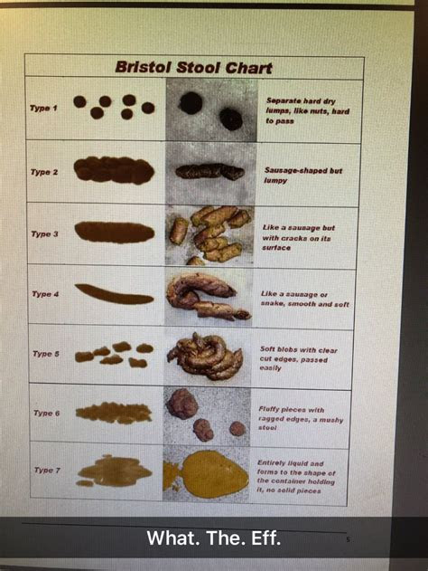 Bristol stool chart this chart is a tool used by health care professionals to assess your stool and look for constipation. printable stool chart