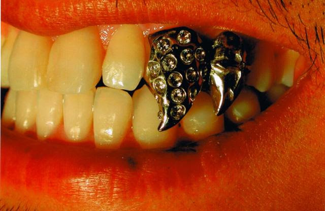 付ける八重歯 牙 できます 歯のおしゃれサロン Teeth Smile
