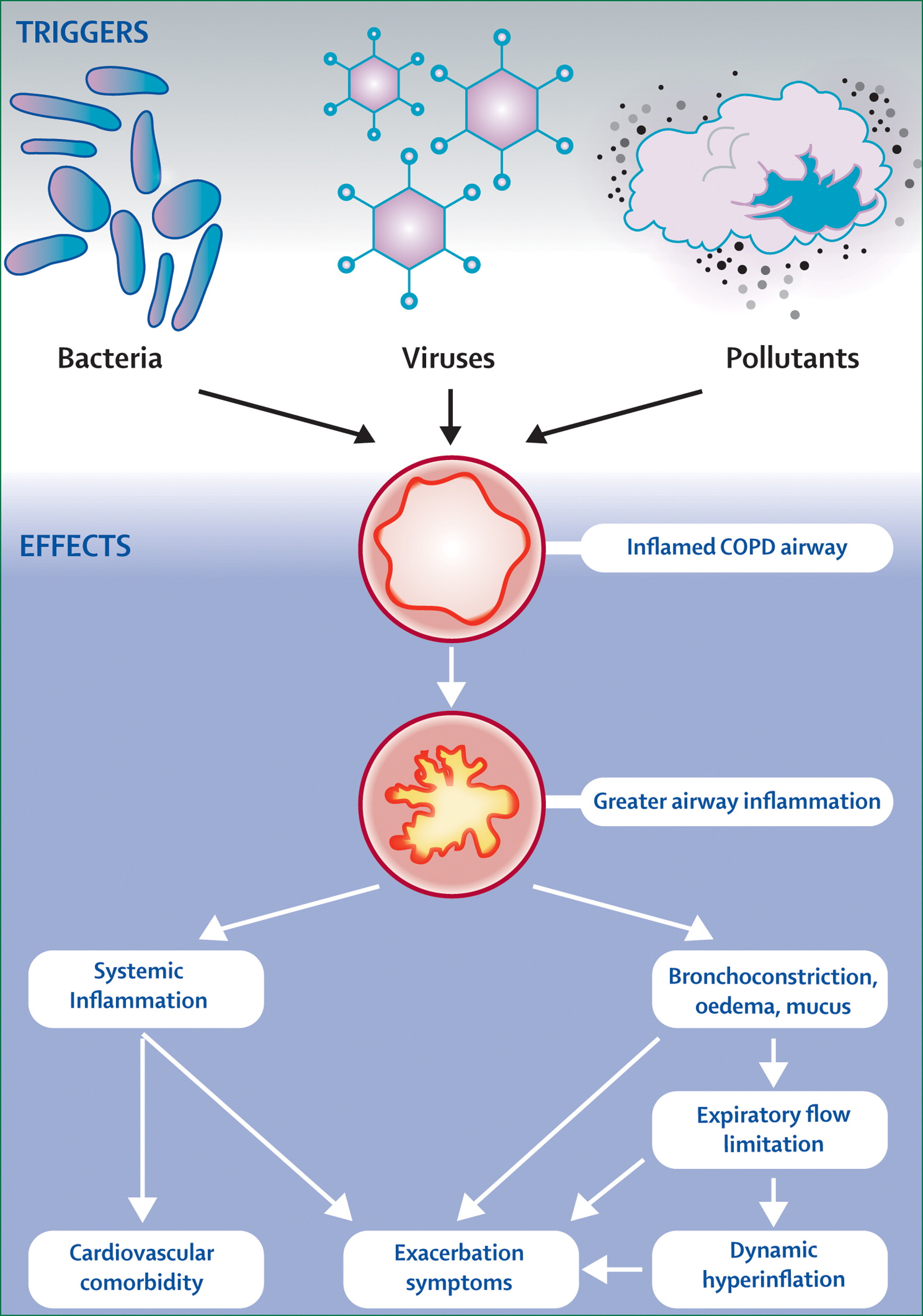 COPD exacerbations: defining their cause and prevention 