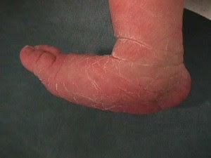 Pieds Du Nourrisson Bebesante Fr