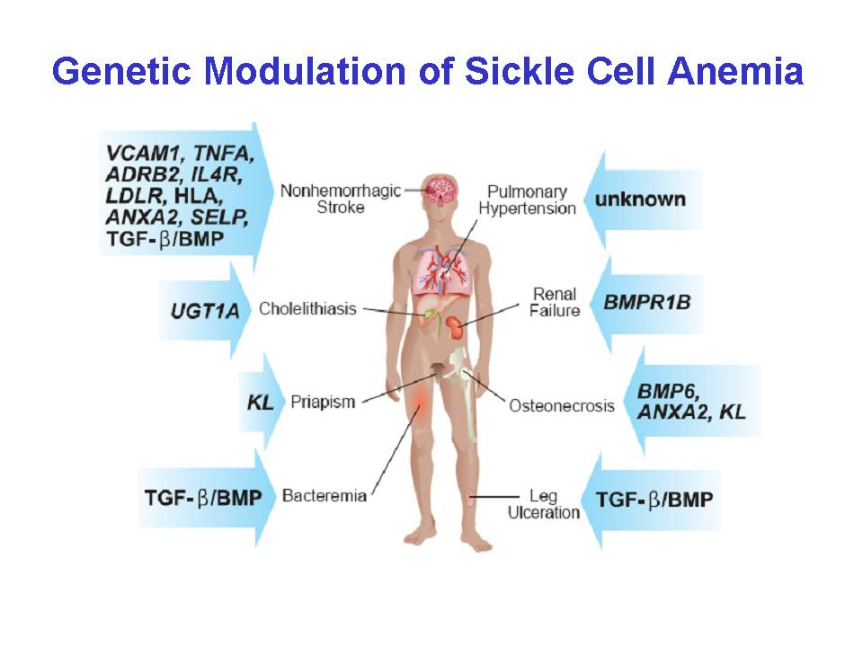 Anemia, sickle cell; Hemoglobin S Disease