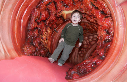 sm0302colon2LNSc.JPG