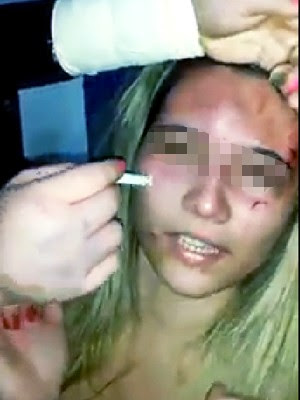 Garota apaga cigarro no rosto de 'rival' por causa de namorado em Praia Grande, SP (Foto: Reprodução/Facebook)