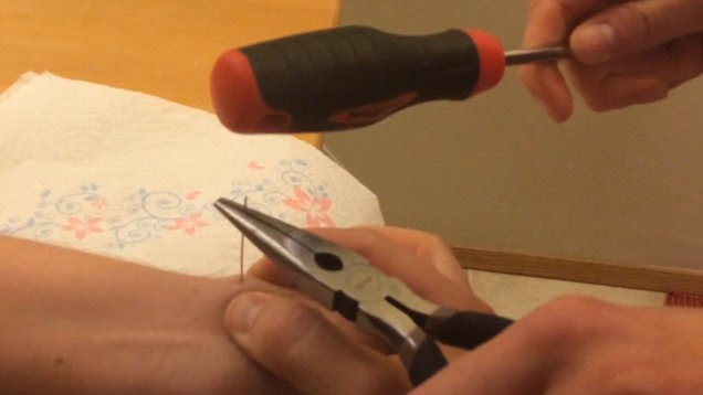 Man pops huge cyst using a needle, pliers and a ...