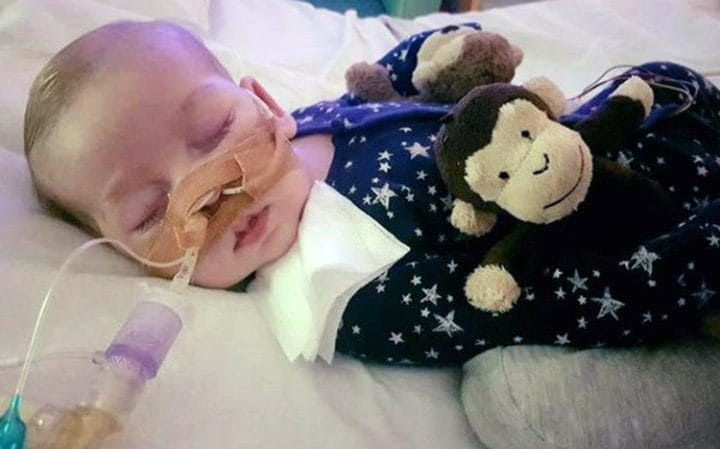 Charlie Gard is unable to move or breathe without a ventilator