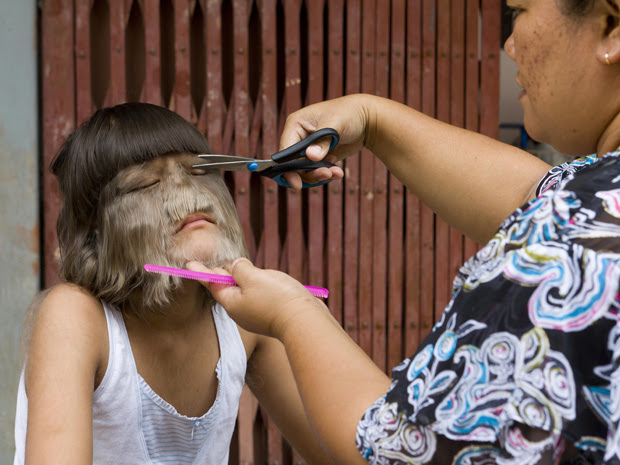 Supatra Sasuphan, menina com o rosto mais peludo do mundo (Foto: Barcroft Media / Getty Images)