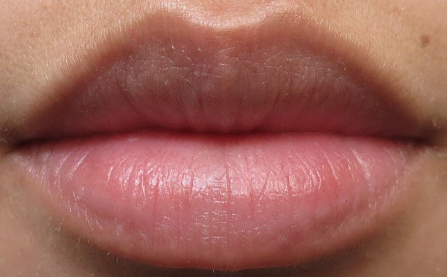 Bare Lips