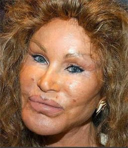 Jocelyne Wildenstein Ou Les Dangers De La Chirurgie Le Piege De La Chirurgie Esthetique