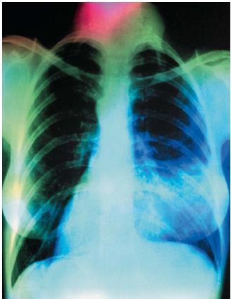 http://www.scienceclarified.com/images/uesc_09_img0496.jpg