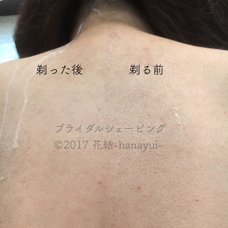 Yちゃん おめでとうございます 千葉市 女性のためのお顔そり ふれけあ Jr本千葉駅から徒歩4分