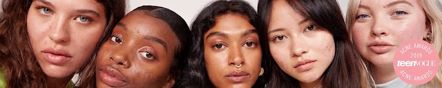 What Is Hyperpigmentation And How Do You Get Rid Of Dark Spots? An Explainer
