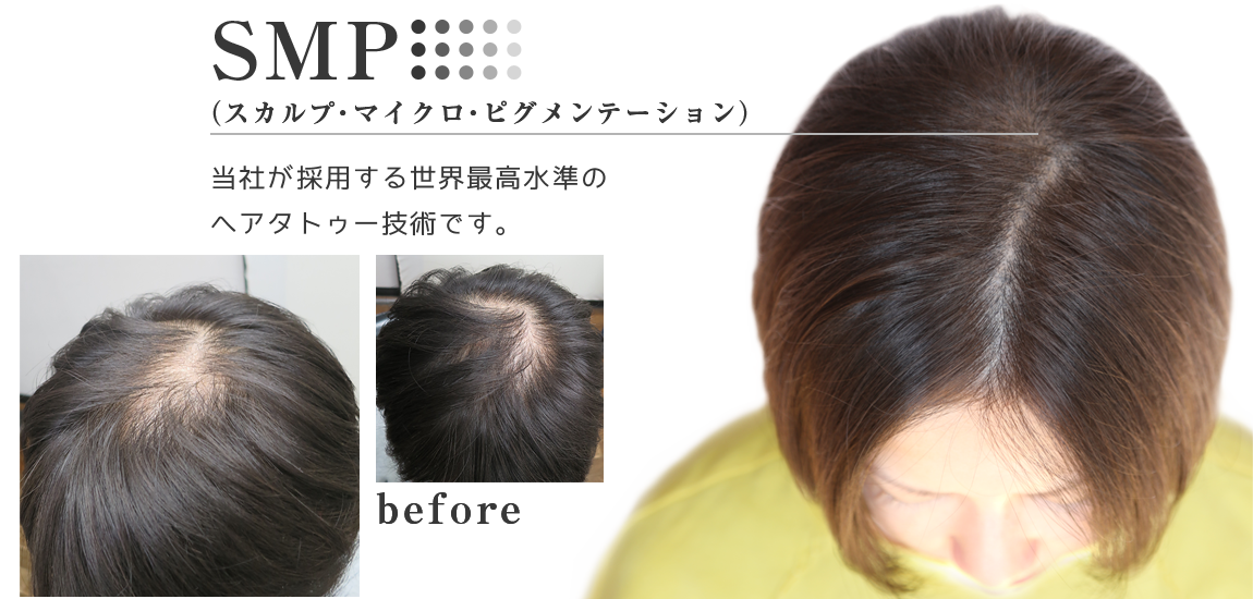 女性 レディースヘアタトゥー料金説明 価格 コース Spj