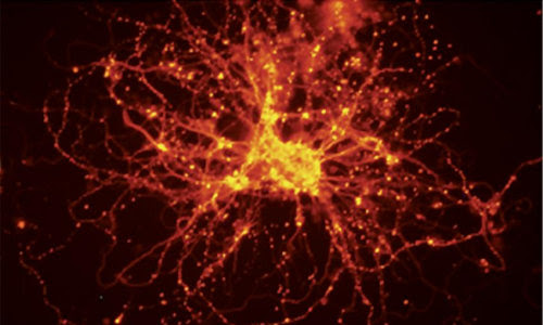 First stem cell study of bipolar disorder yields promising results