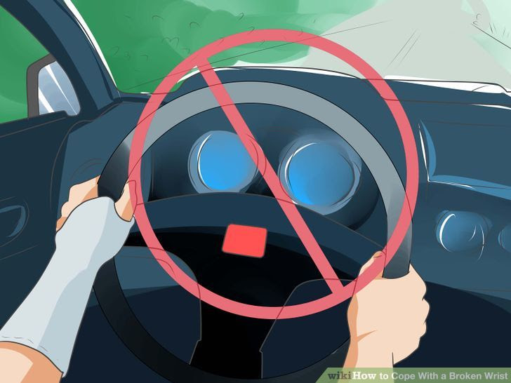 Cope With a Broken Wrist Step 18.jpg