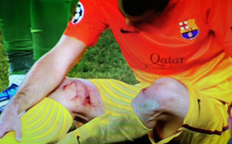 Mascherano quedó lesionado y herido en Francia