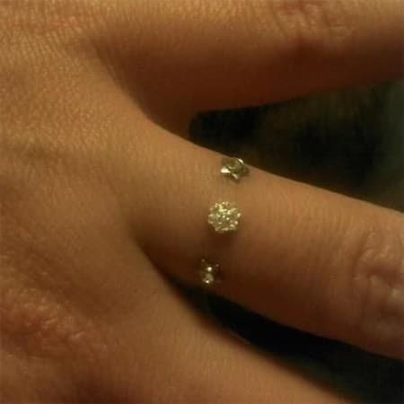  Three Finger skin stinging 