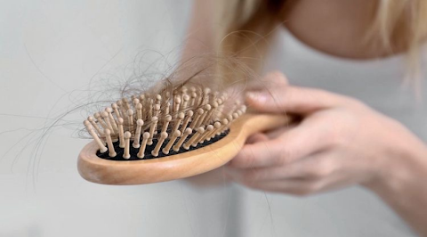rambut rontok lebih dari 100 helai sehari