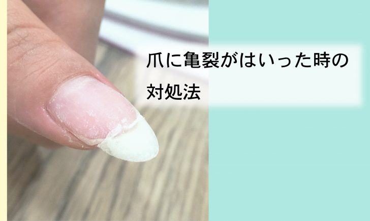 爪に亀裂がはいった時の対処法 フリーズネイル