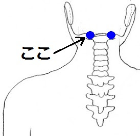 首こり １ 整体師のひとり言