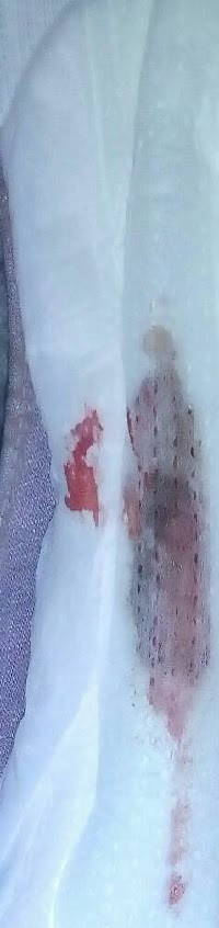 iwarnai idarahi keguguran sama gak sih sama idarahi ihaidi mohon iwarnai idarahi keguguran sama gak sih sama idarahi ihaidi mohon