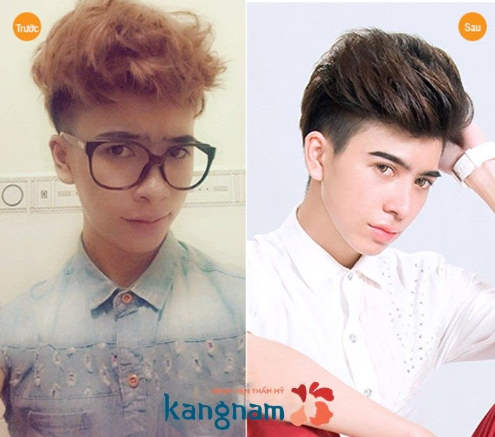 Tài Phát tự tin hơn sau cắt cánh mũi tại Kangnam