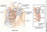 Photos of Most Common Shoulder Injury