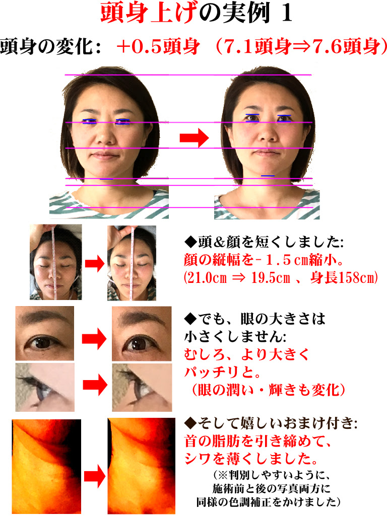 骨格矯正処ムラマサ 整体 カイロプラクティック