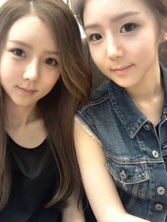 twin sister before after surgery 13 asiantown.net
