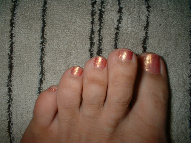 コカイン ラッカス 模倣 足 小指 爪 ない P Stage Jp