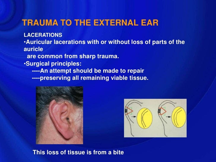Cellulitis of external ear