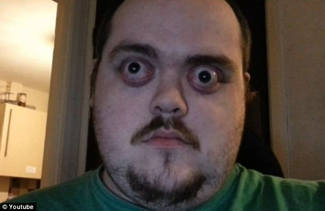 Determined: Mr Doyle will fight to get bigger equipment made so he can be crowned world's biggest eye popper