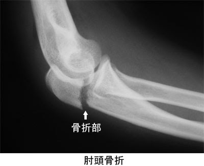 痛みの話q A 八王子整形外科 西八王子駅近くの整形外科専門クリニック