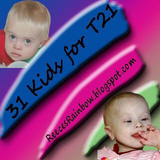 RR 31 for 21