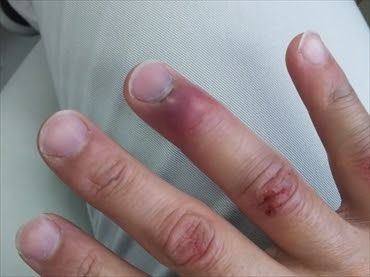 やっちまった 自転車ブログ 青空 ワタル