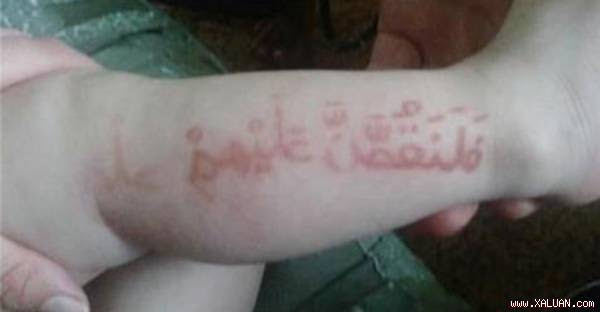 Kỳ bí chữ ‘kinh thánh’ nổi trên chân em bé, nhiều tín đồ tới xem, linh mục còn nói rằng…