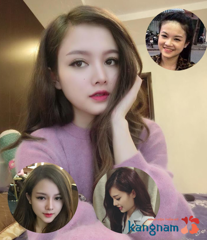 Nâng mũi có bị ưng thư không 2