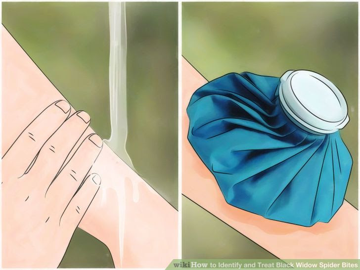 Identify and Treat Black Widow Spider Bites Step 4 Version 3.jpg