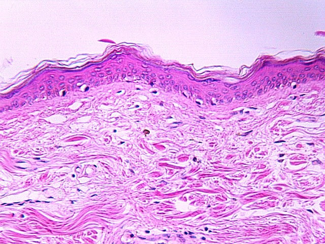 Layers Of The Skin. sure you know each layer.