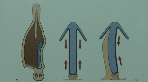 Rhinoplasty cyprus_66.jpg