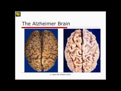The Best 10 Neurocognitive Disorders (Dsm-5 Pdf)