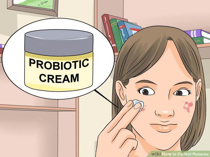 Control Rosacea Step 11 Version 2.jpg