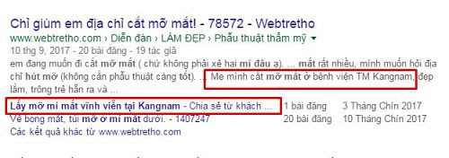 lay-mo-mi-mat-o-dau1