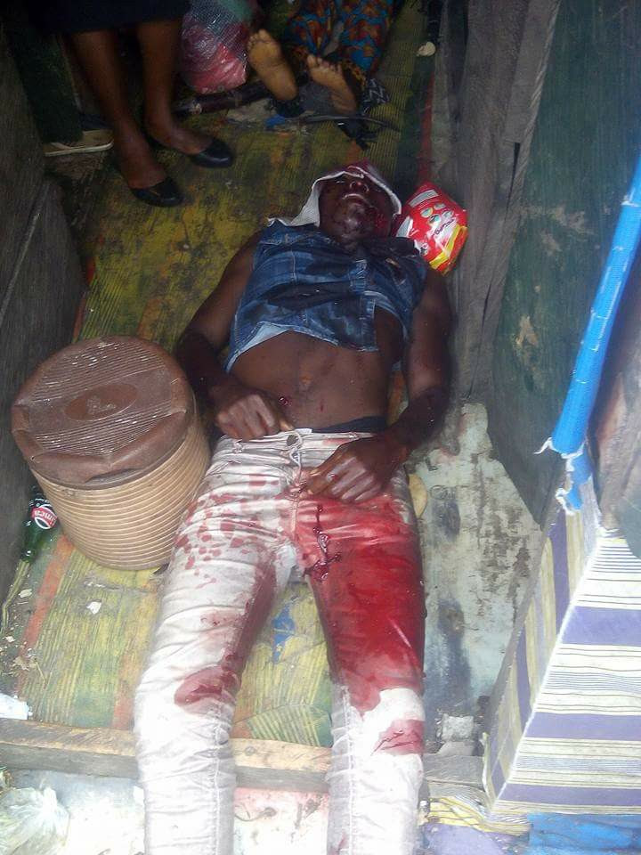Graphic Photos: One Woman and Two Security Operatives Shot ...