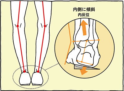 靴の寿命と買い替えのタイミング 足のお悩み百科