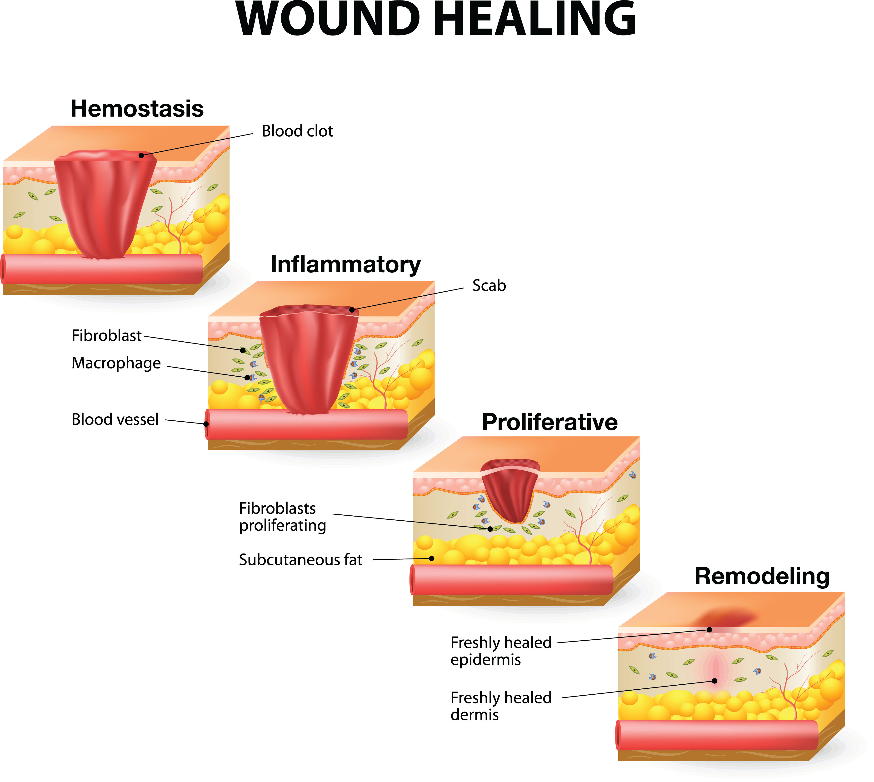 Stages of Healing_image