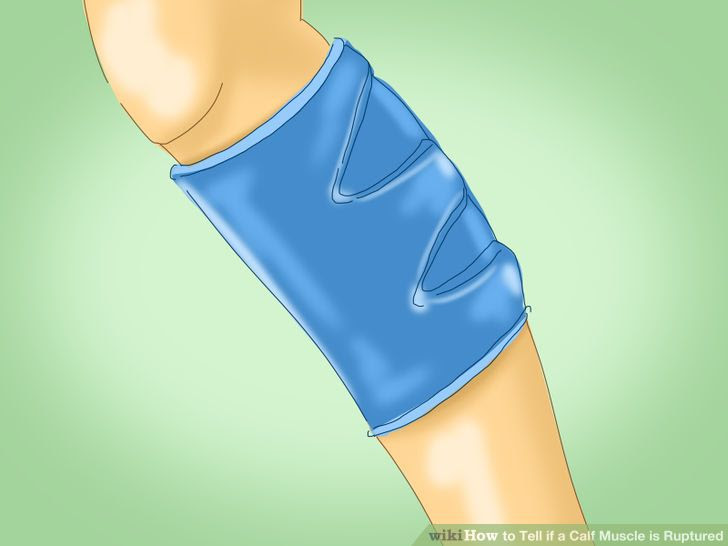 Tell if a Calf Muscle is Ruptured Step 9.jpg