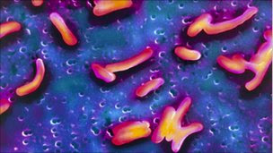 Colour scanning electron micrograph of vibrio cholerae, the cause of cholera in humans